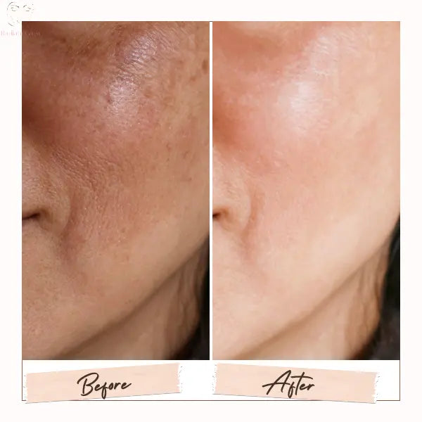 Radiant Glow Niacinamide 15% Face Serum before and after Radiant Glow